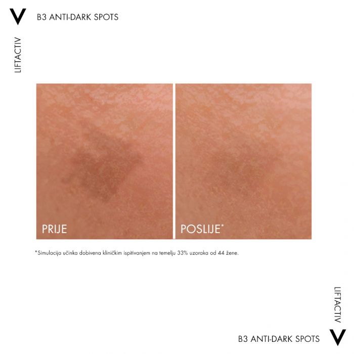 VICHY LIFTACTIV SPECIALIST ANTI-DARK SPOTS B3 SERUM PROTIV HIPERPIGMENTACIJSKIH MRLJA I BORA 