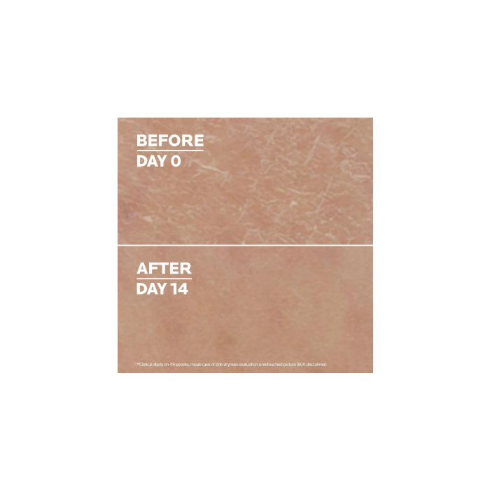 LA ROCHE-POSAY LIPIKAR UREA LAIT 10% 400 ml