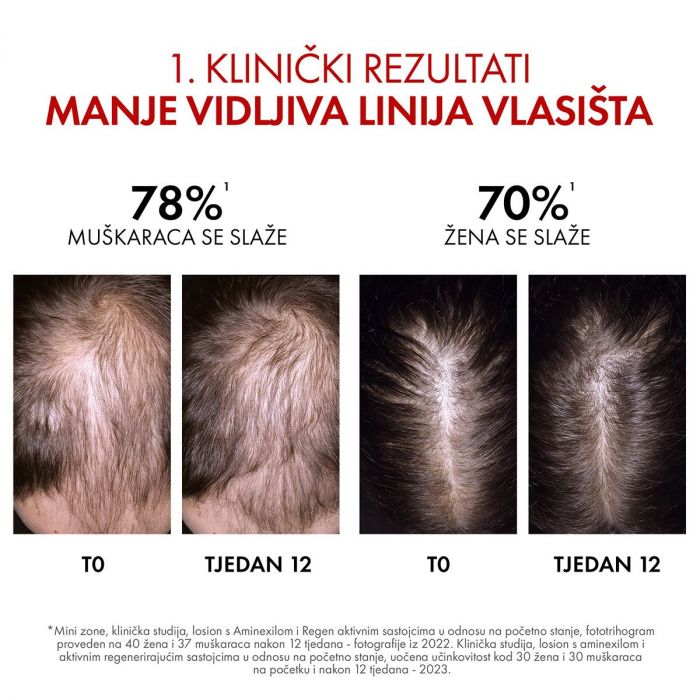 VICHY DERCOS Aminexfil Clinical REGEN Booster Serum za obnovu kose 90 ml